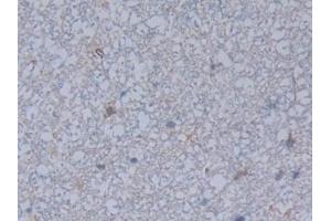 Immunohistochemistry (IHC) image for anti-Ficolin (Collagen/fibrinogen Domain Containing) 1 (FCN1) (AA 25-279) antibody (ABIN7440446)
