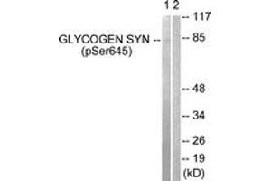 Western blot analysis of extracts from NIH-3T3 cells treated with PMA 125ng/ml 30', using Glycogen Synthase (Phospho-Ser645) Antibody. (Glycogen Synthase antibody  (pSer645))