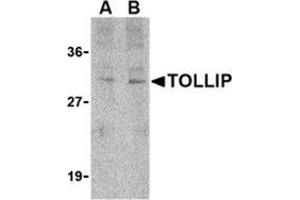 Western blot analysis of TOLLIP in rat brain cell lysate with this product at (A) 1 and (B) 2 μg/ml.