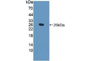 Detection of Recombinant TAGLN2, Human using Polyclonal Antibody to Transgelin 2 (TAGLN2)