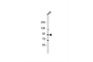 Anti-CRI Antibody at 1:1000 dilution + Hela whole cell lysates Lysates/proteins at 20 μg per lane. (RASA4 antibody)