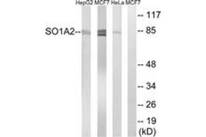Western Blotting (WB) image for anti-Solute Carrier Organic Anion Transporter Family, Member 1A2 (SLCO1A2) (AA 251-300) antibody (ABIN1535391)