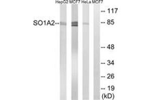 Western blot analysis of extracts from HeLa/MCF-7/HepG2 cells, using SLCO1A2 Antibody.