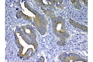 IHC analysis of MMP10 using anti-MMP10 antibody (A03759). (MMP10 antibody  (AA 239-476))