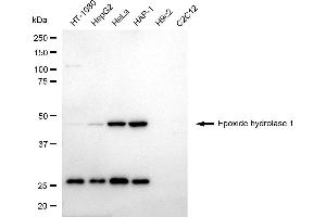 Western blotting analysis using epoxide hydrolase 1 antibody (ABIN7798484). (EPHX1 antibody)