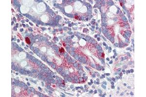 Immunohistochemistry (IHC) image for anti-Mediator Complex Subunit 4 (MED4) (C-Term) antibody (ABIN2784237) (MED4 antibody  (C-Term))