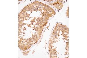 Immunohistochemical analysis of (ABIN391446 and ABIN2841429) on paraffin-embedded human testis tissue was performed on the Leica®BOND RXm. (SPAG9 antibody  (N-Term))