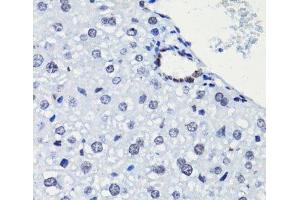 Immunohistochemistry of paraffin-embedded Mouse liver using Acetyl-Histone H2A-K5 Polyclonal Antibody at dilution of 1:100 (40x lens).