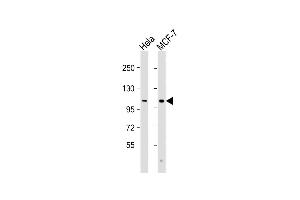 All lanes : Anti-VLDLR Antibody (C-Term) at 1:2000 dilution Lane 1: Hela whole cell lysate Lane 2: MCF-7 whole cell lysate Lysates/proteins at 20 μg per lane. (VLDLR antibody  (AA 608-642))