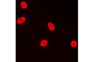 Immunofluorescent analysis of TFDP1 staining in A431 cells. (DP1 antibody  (C-Term))