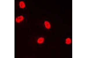 Immunofluorescent analysis of TFDP1 staining in A431 cells. (DP1 antibody  (C-Term))