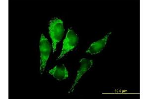 Immunofluorescence of purified MaxPab antibody to DLST on HeLa cell. (DLST antibody  (AA 1-453))