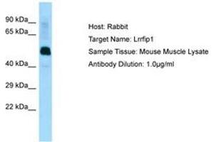 Image no. 1 for anti-Leucine Rich Repeat (In FLII) Interacting Protein 1 (LRRFIP1) (AA 111-160) antibody (ABIN6749838)