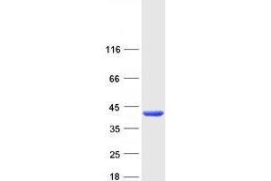 Validation with Western Blot (UPP2 Protein (Transcript Variant 1) (Myc-DYKDDDDK Tag))
