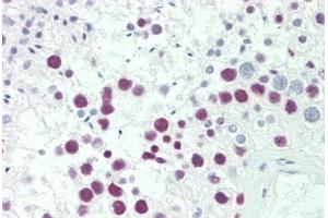 Human Testis: Formalin-Fixed, Paraffin-Embedded (FFPE) (SRP54 antibody  (AA 346-374))