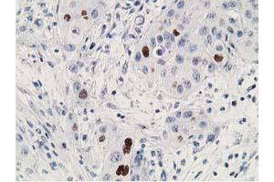 Image no. 2 for anti-Tumor Protein P53 (TP53) antibody (ABIN1499968) (p53 antibody)