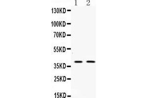 Western blot analysis of Doublecortin expression in rat brain extract ( Lane 1) and mouse brain extract ( Lane 2). (Doublecortin antibody  (N-Term))