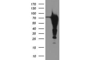 Western Blotting (WB) image for anti-Epsin 2 (EPN2) antibody (ABIN1498053) (Epsin 2 antibody)