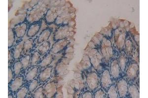 Immunohistochemistry (IHC) image for anti-Coagulation Factor XIII, A1 Polypeptide (F13A1) (AA 372-616) antibody (ABIN7442897)