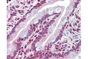 Immunohistochemistry (IHC) image for anti-ATP-Binding Cassette, Sub-Family C (CFTR/MRP), Member 8 (ABCC8) (N-Term) antibody (ABIN2781496) (ABCC8 antibody  (N-Term))