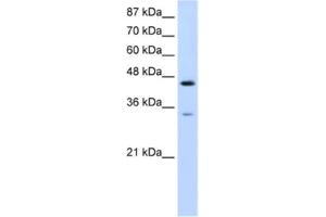 Western Blotting (WB) image for anti-Splicing Factor 3b, Subunit 4, 49kDa (SF3B4) antibody (ABIN2462194) (SF3B4 antibody)