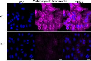 Immunocytochemical staining of HepG2 cells using Epidermal growth factor receptor antibody (ABIN7798478), 1:1,000), Top panel: wild-type (WT), Bottom panal: Adiponectin receptor 1 shRNA knockdown (KD). (Recombinant EGFR antibody)