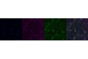 Immunohistochemistry (IHC) image for anti-Cholinergic Receptor, Nicotinic, alpha 6 (CHRNA6) antibody (ABIN7456066) (CHRNA6 antibody)