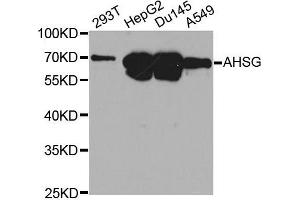 Western blot analysis of extracts of various cell lines, using AHSG antibody. (Fetuin A antibody  (AA 19-300))
