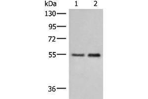 Western blot analysis of Human placenta tissue and 231 cell lysates using HTRA4 Polyclonal Antibody at dilution of 1:400 (HTRA4 antibody)