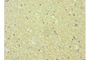 Immunohistochemistry of paraffin-embedded human brain tissue using ABIN7151874 at dilution of 1:100 (Ephrin A1 antibody  (AA 19-182))