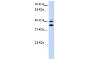 Image no. 1 for anti-Solute Carrier Family 25, Member 32 (SLC25A32) (AA 215-264) antibody (ABIN6743231) (SLC25A32 antibody  (AA 215-264))