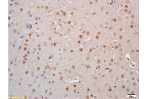 Formalin-fixed and paraffin embedded rat brain tissue labeled Anti-HSTF2/HSF2 Polyclonal Antibody, Unconjugated (ABIN686137) at 1:200, followed by conjugation to the secondary antibody and DAB staining (HSF2 antibody  (AA 401-536))