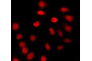 Immunofluorescent analysis of Histone H4 (AcK12) staining in A431 cells. (Histone H4 antibody  (acLys12, N-Term))