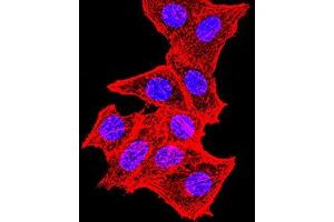 Immunofluorescence (IF) image for anti-Topoisomerase (DNA) II alpha 170kDa (TOP2A) (AA 1100-1530) antibody (ABIN7193564)