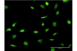 Immunofluorescence (IF) image for anti-Small Nuclear RNA Activating Complex, Polypeptide 4, 190kDa (SNAPC4) (AA 53-162) antibody (ABIN562931)