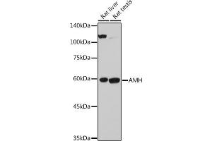 Western blot analysis of extracts of various cell lines, using AMH antibody (ABIN7265629) at 1:500 dilution. (AMH antibody  (AA 20-280))