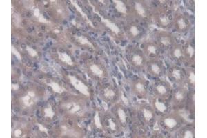 DAB staining on IHC-P; Samples: Rat Kidney Tissue (Rhotekin antibody  (AA 296-548))