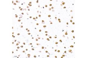 Immunohistochemistry (Paraffin-embedded Sections) (IHC (p)) image for anti-Topoisomerase (DNA) II alpha 170kDa (TOP2A) antibody (ABIN7075937)