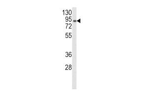 Western blot analysis of AOC3 Antibody (Center) (ABIN652478 and ABIN2842325) in CEM cell line lysates (35 μg/lane). (AOC3 antibody  (AA 613-640))