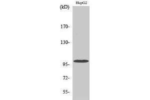 Western Blotting (WB) image for anti-Vav 2 Guanine Nucleotide Exchange Factor (VAV2) (Tyr299) antibody (ABIN3187458)