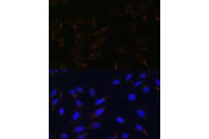 Immunofluorescence analysis of U-2 OS cells using IL13R antibody (ABIN7267987) at dilution of 1:100. (IL13RA2 antibody)