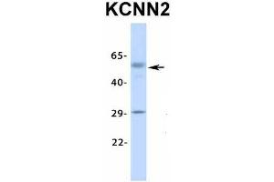Host:  Rabbit  Target Name:  KCNN2  Sample Type:  Human Fetal Lung  Antibody Dilution:  1. (KCNN2 antibody  (Middle Region))