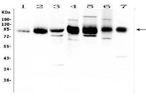 Western blot analysis of ICAM1 using anti-ICAM1 antibody (ABIN5692991).