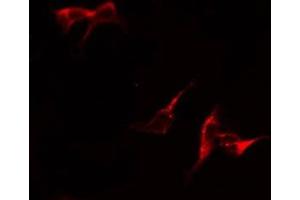 ABIN6279097 staining COLO205 by IF/ICC. (GPT2 antibody  (Internal Region))