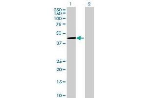 Lane 1: CYP26A1 transfected lysate ( 48.
