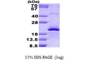 Image no. 1 for Endothelin 2 (EDN2) protein (His tag) (ABIN1098787)
