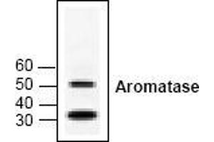 Image no. 1 for anti-Cytochrome P450, Family 19, Subfamily A, Polypeptide 1 (CYP19A1) antibody (ABIN126953) (Aromatase antibody)