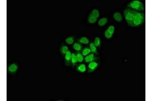 Immunofluorescent analysis of PC-3 cells using ABIN7159730 at dilution of 1:100 and Alexa Fluor 488-congugated AffiniPure Goat Anti-Rabbit IgG(H+L) (MGST3 antibody  (AA 30-70))