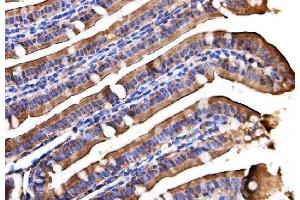 IHC analysis of AGPAT2 using anti-AGPAT2 antibody (ABIN7602435). (AGPAT2 antibody  (AA 77-178))