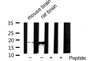 Western blot analysis of SOD1 Antibody expression in rat brain and mouse brain tissues lysates. (SOD1 antibody  (Internal Region))